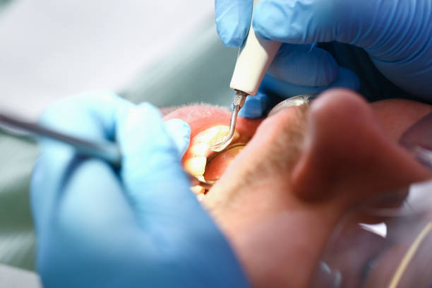 Best Emergency Denture Repair in Dublin, OH
